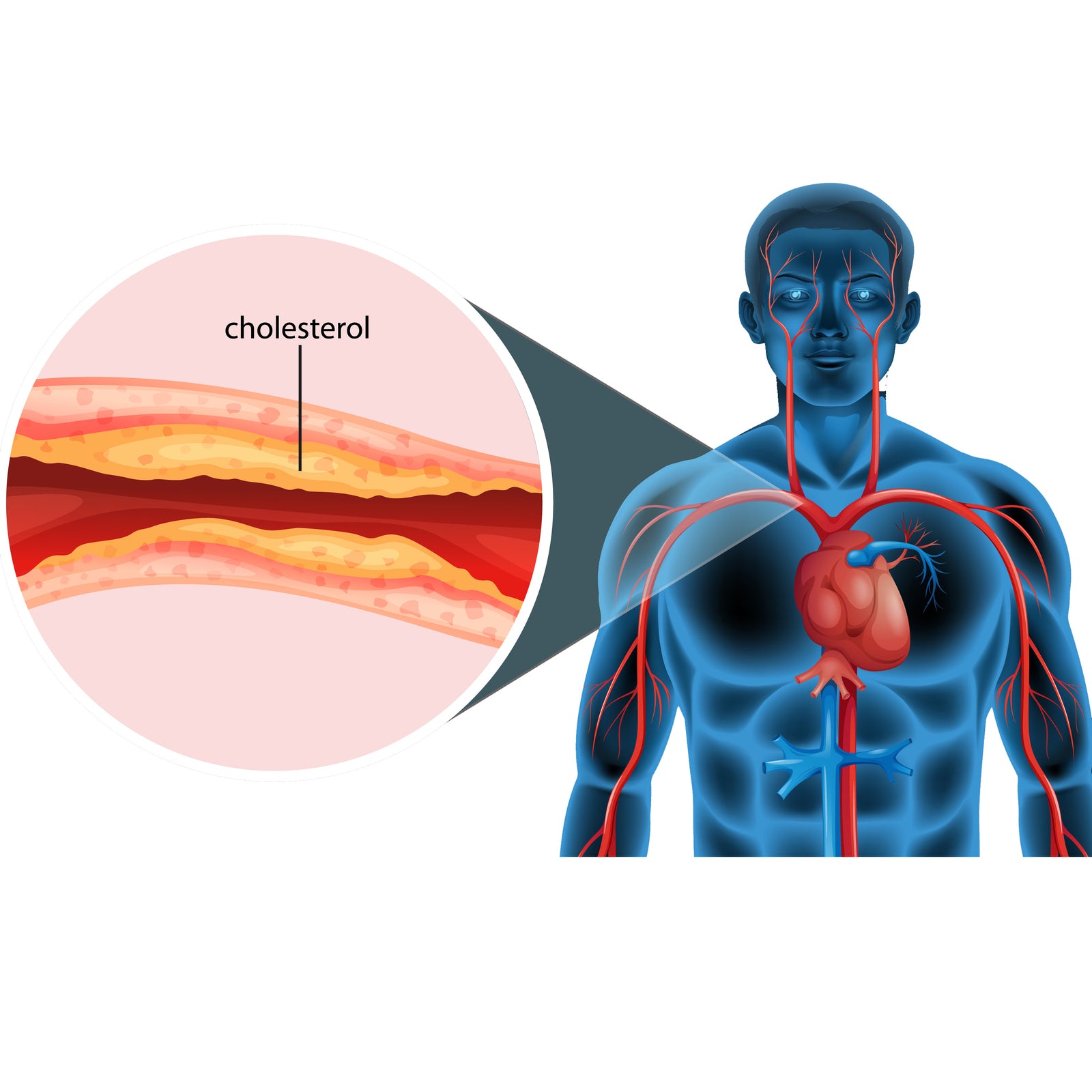 ליקוריץ פלוס המקורי מסייע בטיפול בכולסטרול רע